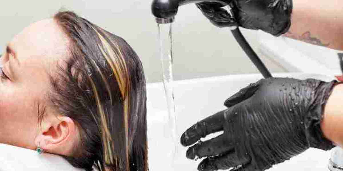 Columbia SC’s Trusted Hair Restoration Clinic for Lasting Care